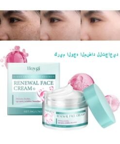 Hoygi Face Cream 14-Day Skin Beauty Regimen Melasma, Freckles Age Spots, Wrinkles Smoother, Dark Spots Cream, For Melasma And Freckles Treatment For All Skin Types, Anti-Wrinkle Face Cream