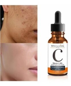 MOOYAM Vitamin C Face Serum - Anti-Aging Whitening Serum, Dark Spot Corrector, Fine Lines and Wrinkles