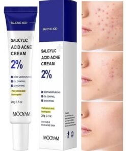 MOOYAM 2% Salicylic Acid Acne Cream, for Face and Body Deep Moisturizing Oil Control and Smoothing with Plant Salicylic Acid and Soothing Skin Suitable for Acne Skin 20g