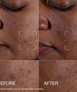 Even Better Clinical™ Dark Spot Clearing Serum