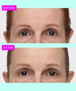 Alternative view of Protini™ Polypeptide Cream