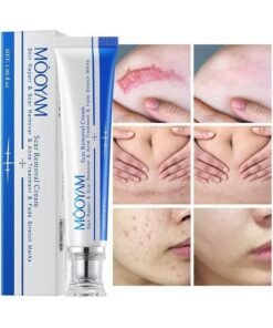 MOOYAM Scar Removal Cream Skin Treatment for Scars Stretch Marks and Acne Marks Improves Skin Texture with Deep Moisturization for All Skin Types
