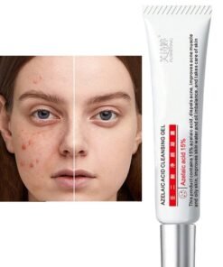 FUSHITING Azelaic Acid Cleansing Gel,Azelaic Acid 15% Acne Tratment Cream, Acne Cream for Face, Spot Treatment, Anti Acne Gel For Spot Prone Skin, Rosacea Reducing Relief Pimple Breakouts Blackhead Pigmentation and Redness,Hydrate 15g